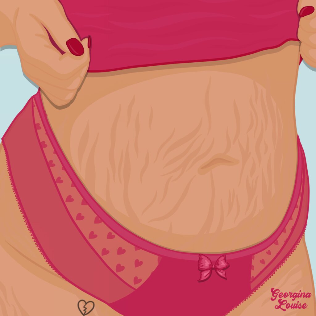 Body Positivity and Skin Positivity