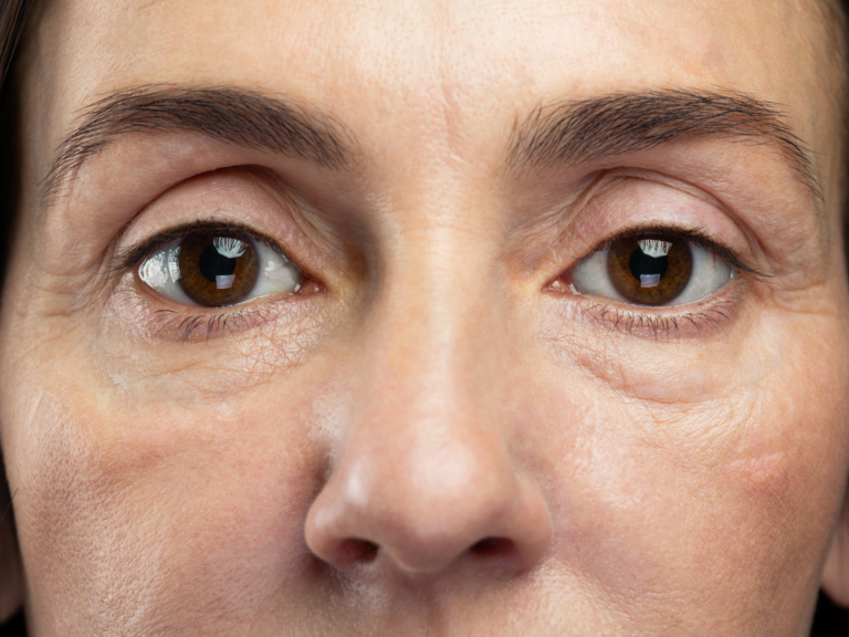 Even Your Eyeballs Lose Collagen as You Age
